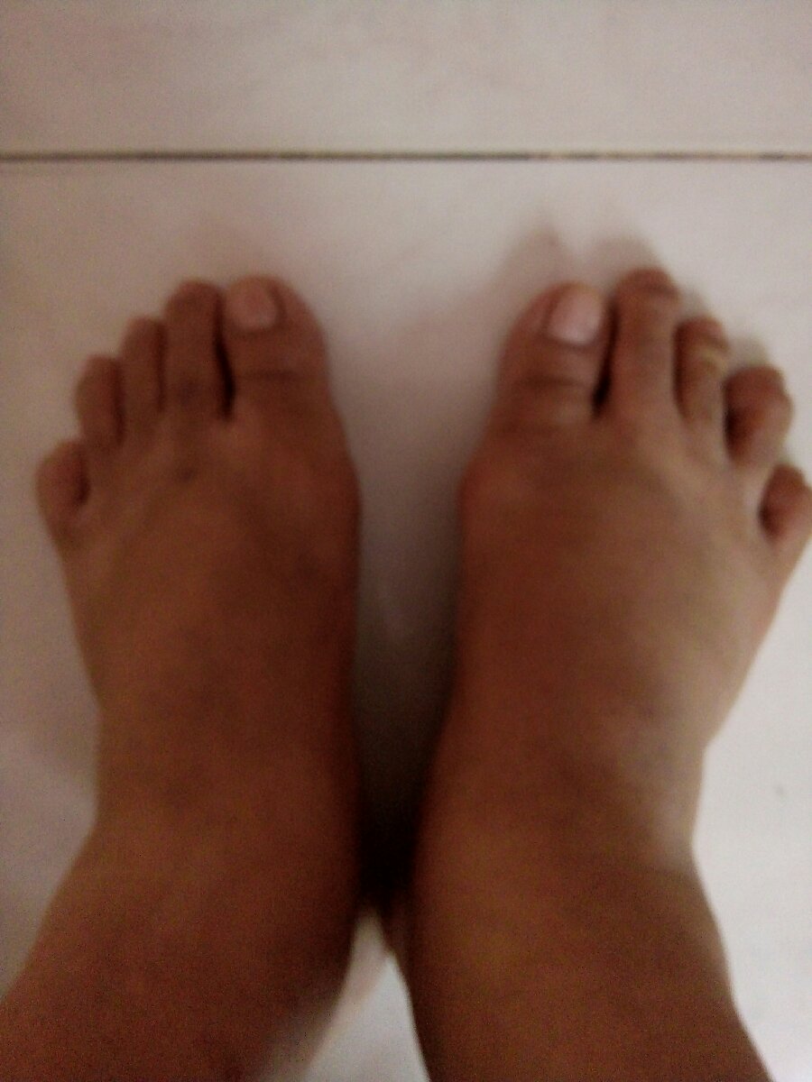 Brown feet
