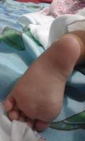 baby toe