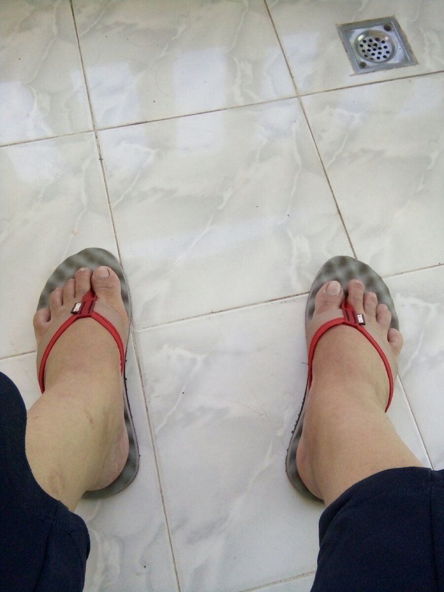 Red strap