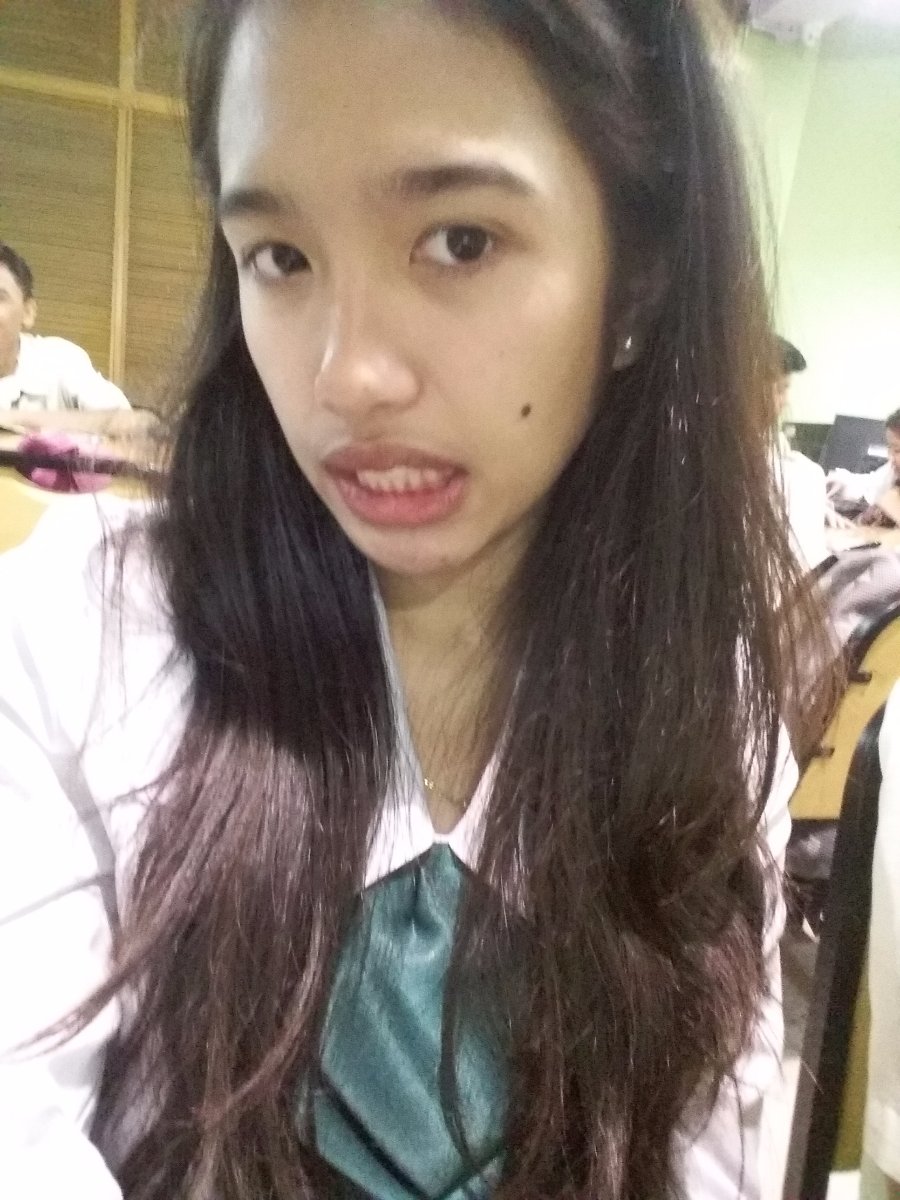 That big forehead, lib