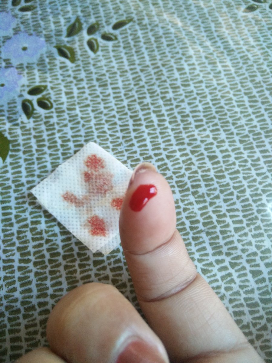 blood sugar check, normal