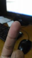 Finger