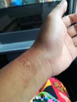 Scar, hand, mark, old, memory, wound, healed