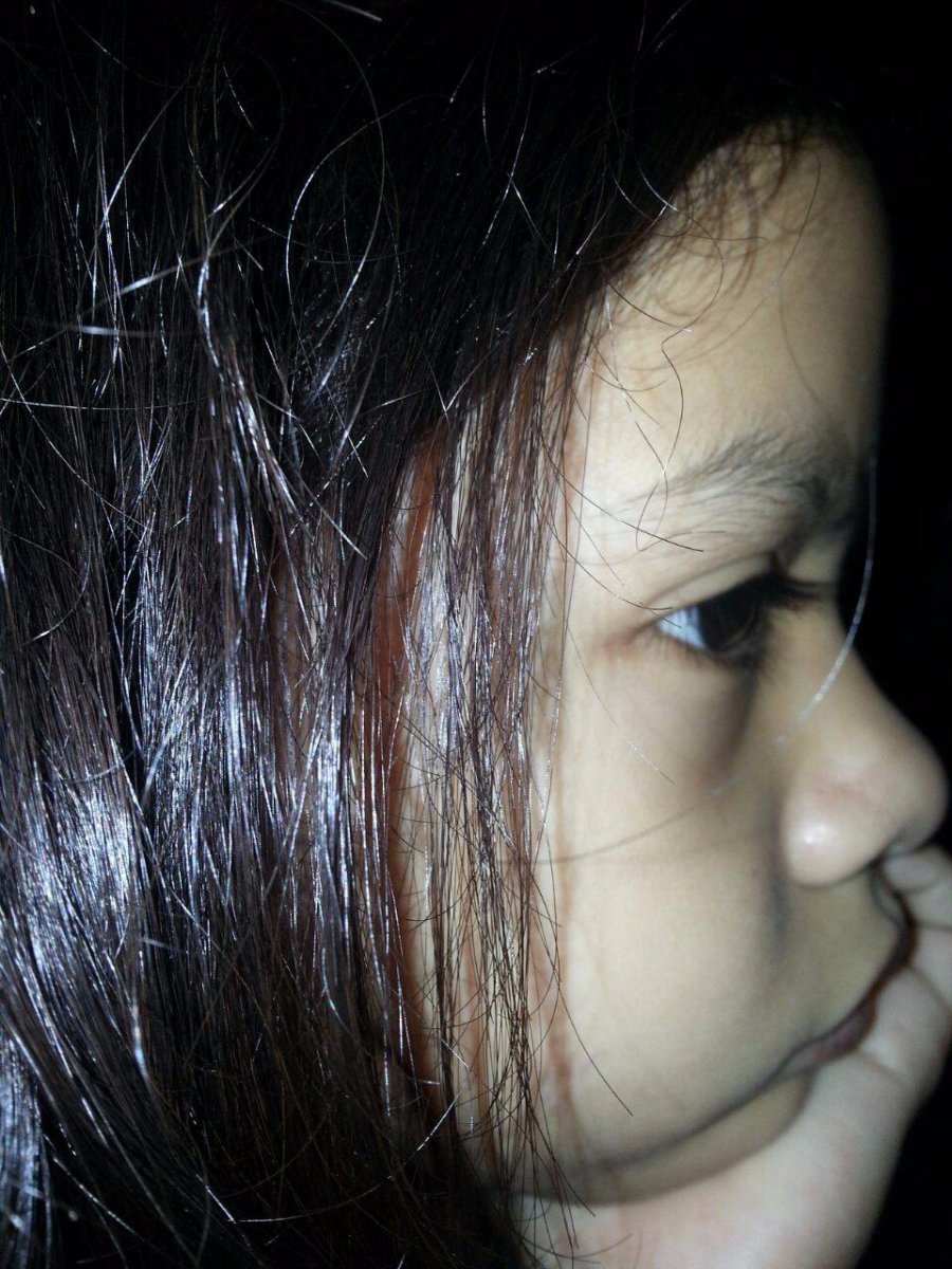 #me #sideview