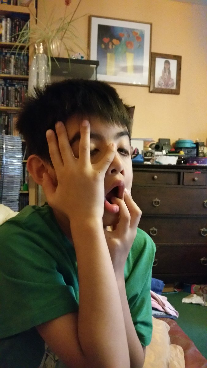 It seems my son might have been involved in a disfiguring accident. . . 