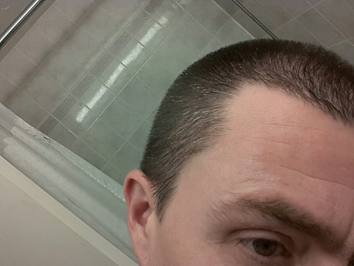 damn thats a lot of grey hairs growing