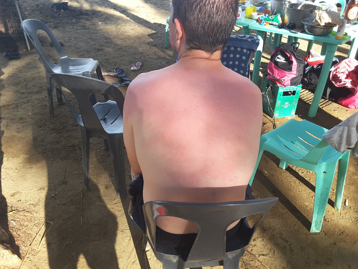 its more er fun in the philippines Too long in the sun still suffering