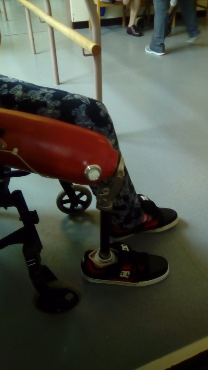 Kim, with her new leg 