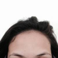 Big forehead