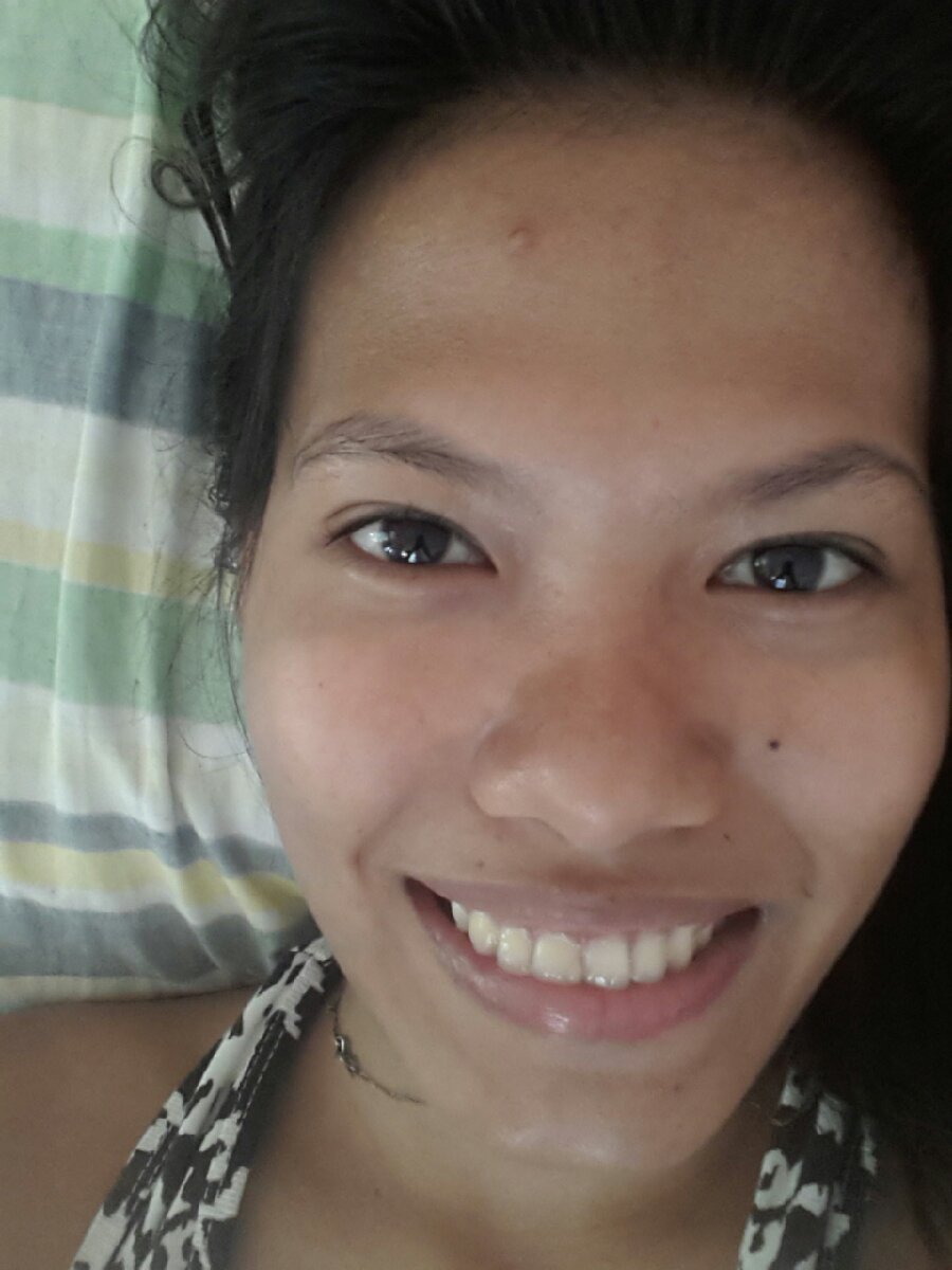 Hello pimples Feels like im having a third eye oh dear