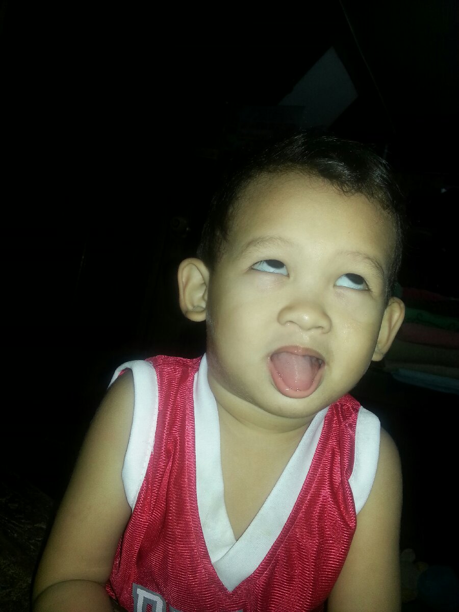 That weird face