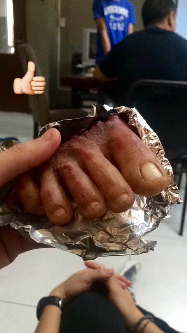 Prosthetic, Art